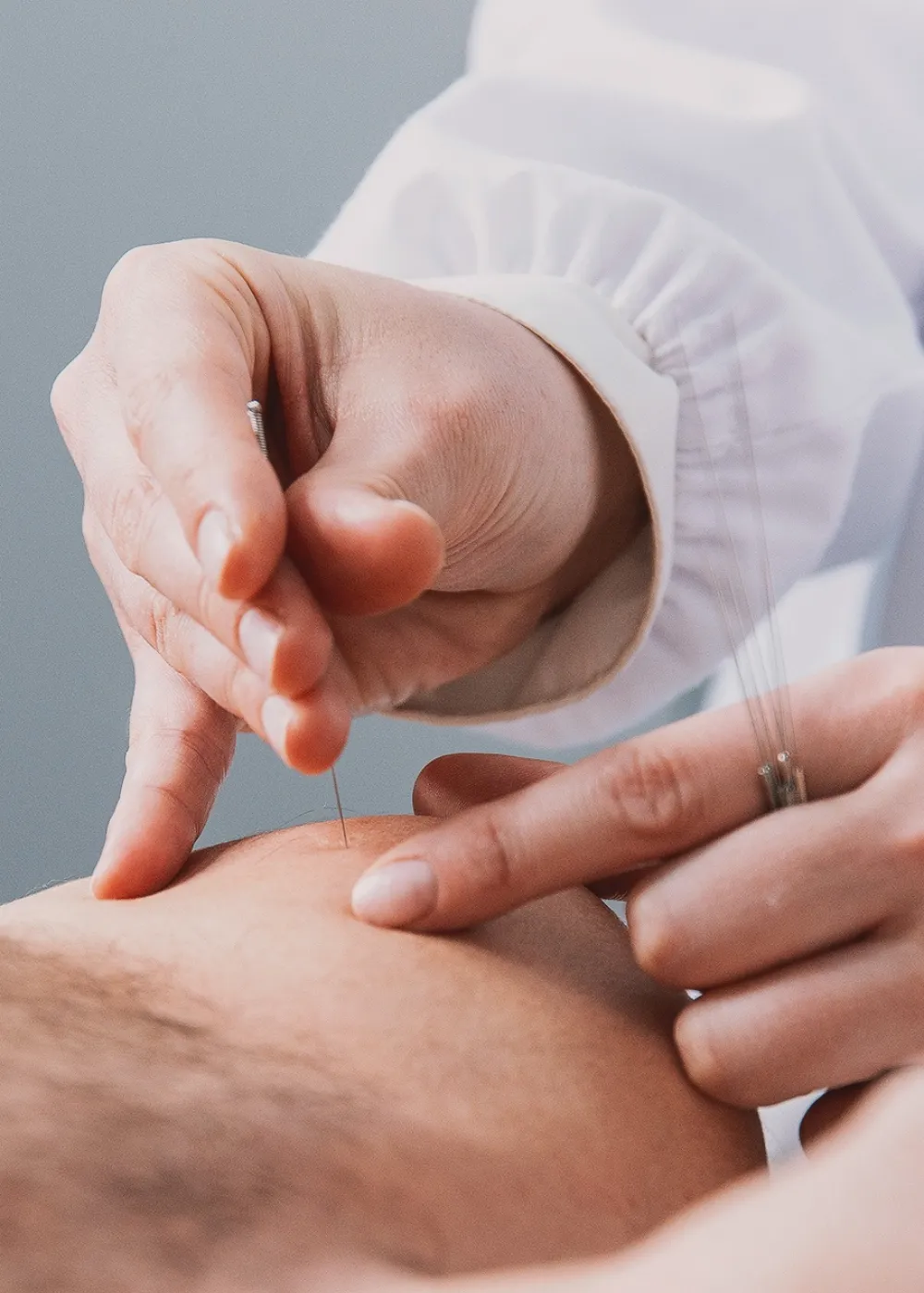Acupuntura, Medicina Tradicional China en Valencia